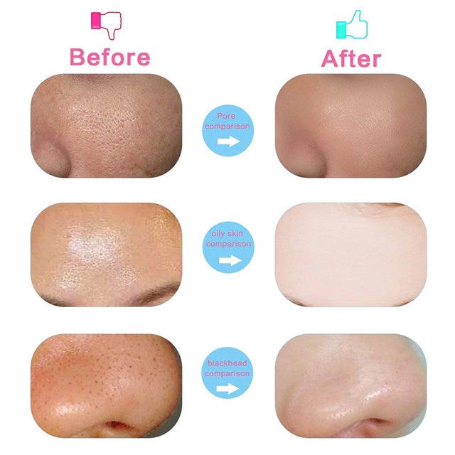 5 in 1 Facial Electric Cleanser and Massager, Electric Machine Beauty , Beauty Care Brush for Removing Blackhead , Beauty Tool Device